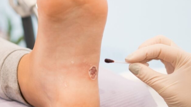 Learn-About-Our-wound-care